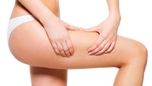 cómo combatir la celulitis